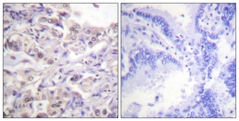 hnRPD (Phospho-Ser83) Antibody