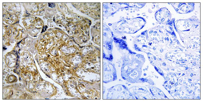 PAK1 (Phospho-Ser199) Antibody