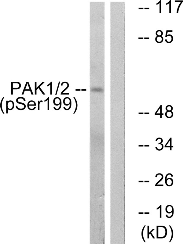 PAK1 (Phospho-Ser199) Antibody