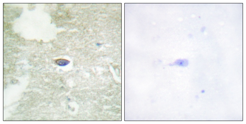 TGF β Receptor II (Phospho-Ser225/250) Antibody