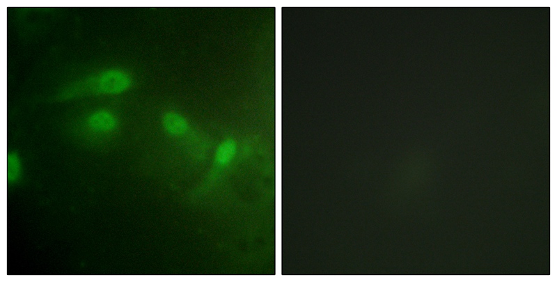 MDM2 (Phospho-Ser186/Ser188) Antibody