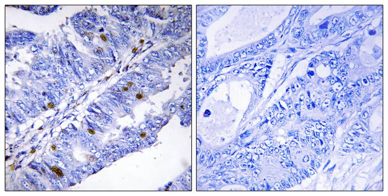 Nuclear Receptor NR4A1 (Phospho-Ser351) Antibody