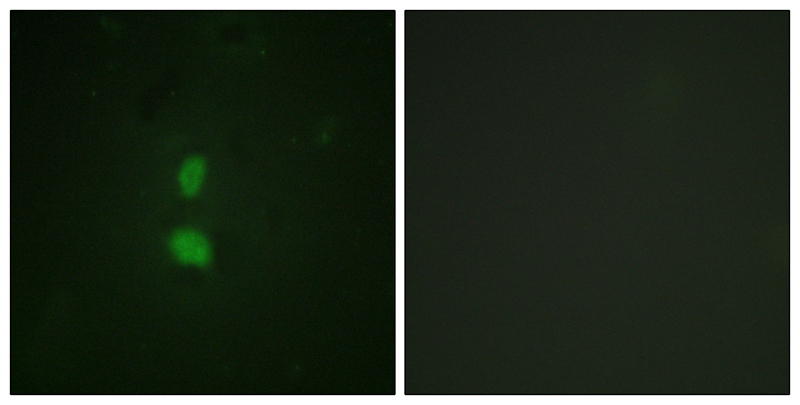 SNAI1 (Phospho-Ser246) Antibody