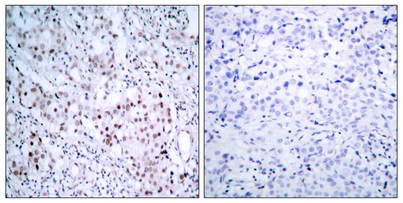 c-Jun (Phospho-Ser63) Antibody