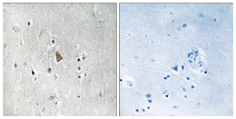 IGF1R (Phospho-Tyr1346) Antibody