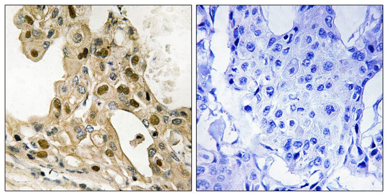 p53 (Phospho-Thr387) Antibody