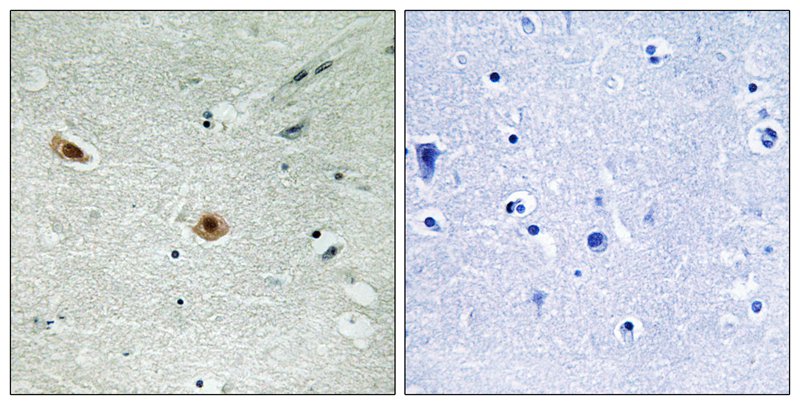 Retinoblastoma (Phospho-Ser608) Antibody