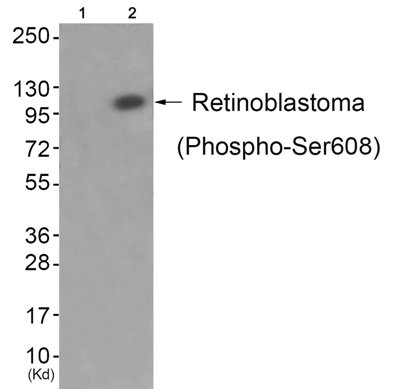 Retinoblastoma (Phospho-Ser608) Antibody