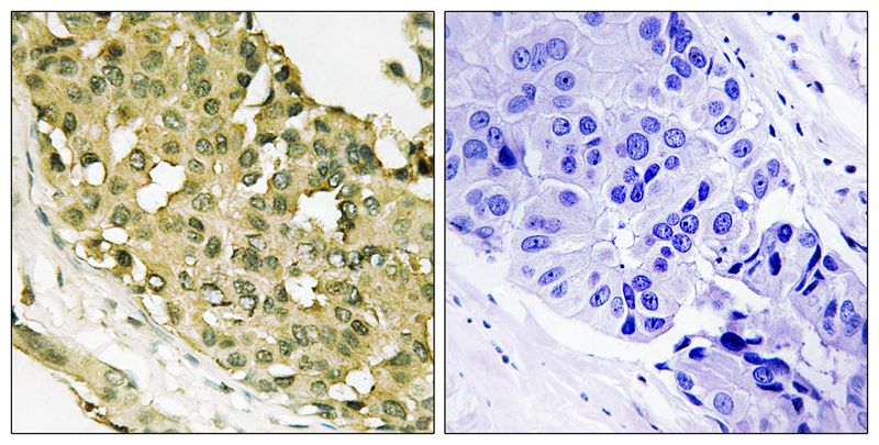 STMN1 (Phospho-Ser63) Antibody