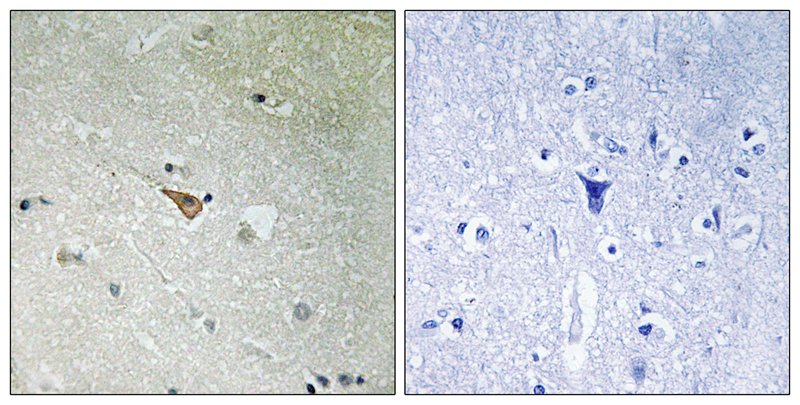 ALK (Phospho-Tyr1096) Antibody