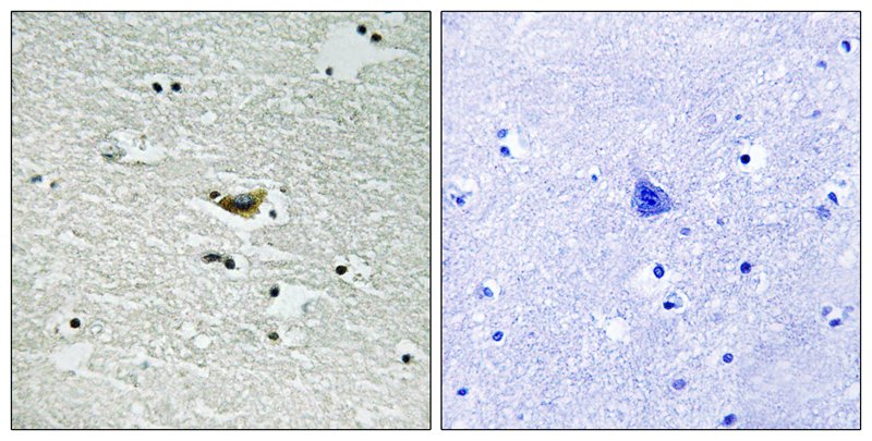 CK-1α (Phospho-Tyr294) Antibody