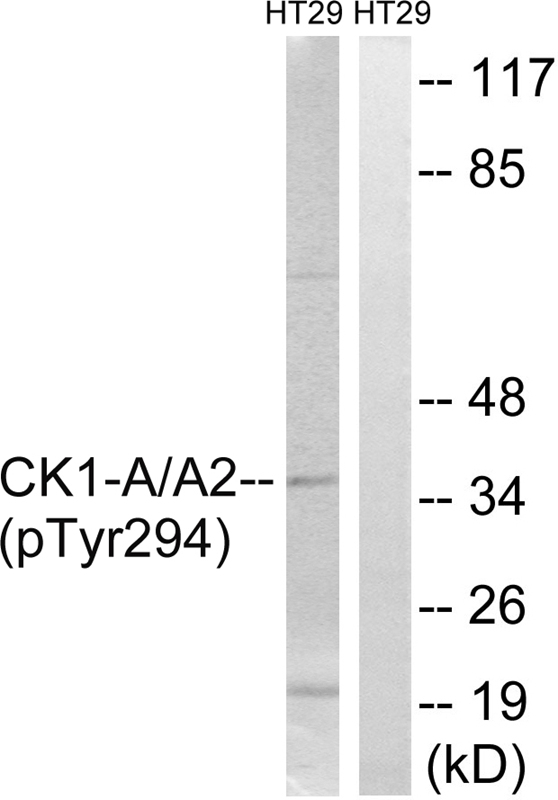 CK-1α (Phospho-Tyr294) Antibody