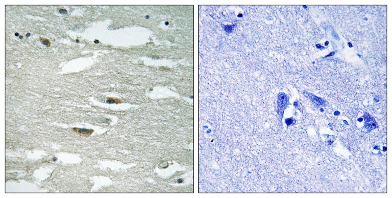 ILK (Phospho-Ser246) Antibody