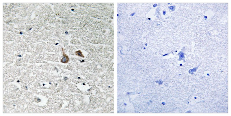 IRAK1 (Phospho-Ser376) Antibody