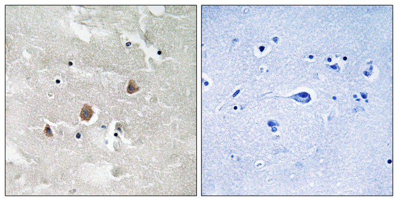 MAP3K1 (Phospho-Thr1402) Antibody