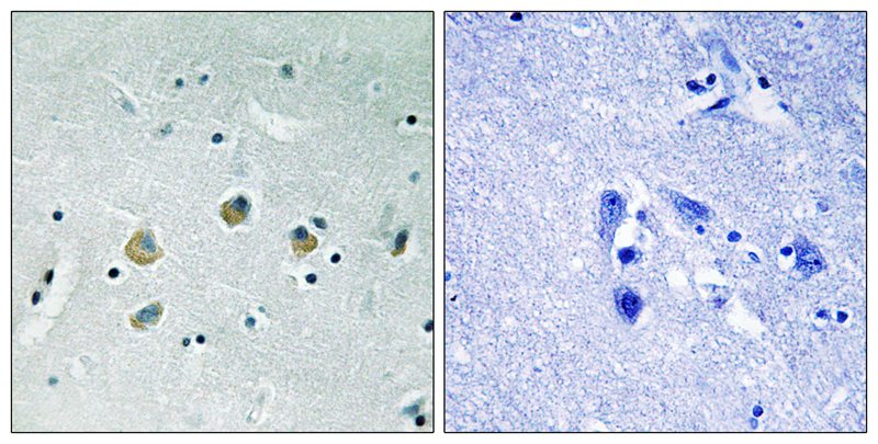 MAP3K8 (Phospho-Ser400) Antibody