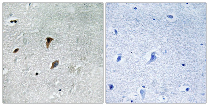 MAP2K3 (Phospho-Thr222) Antibody