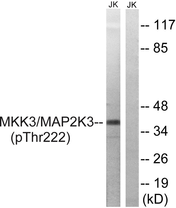 MAP2K3 (Phospho-Thr222) Antibody