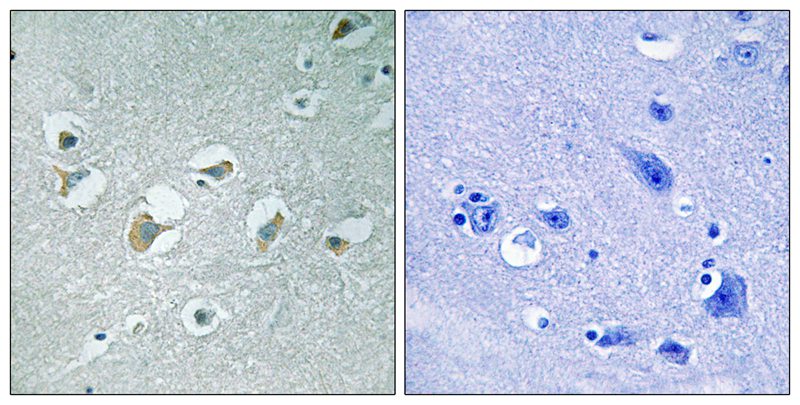 MLK1/2 (Phospho-Thr312/266) Antibody