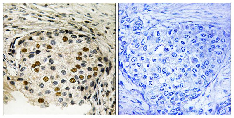 OSR1 (Phospho-Thr185) Antibody