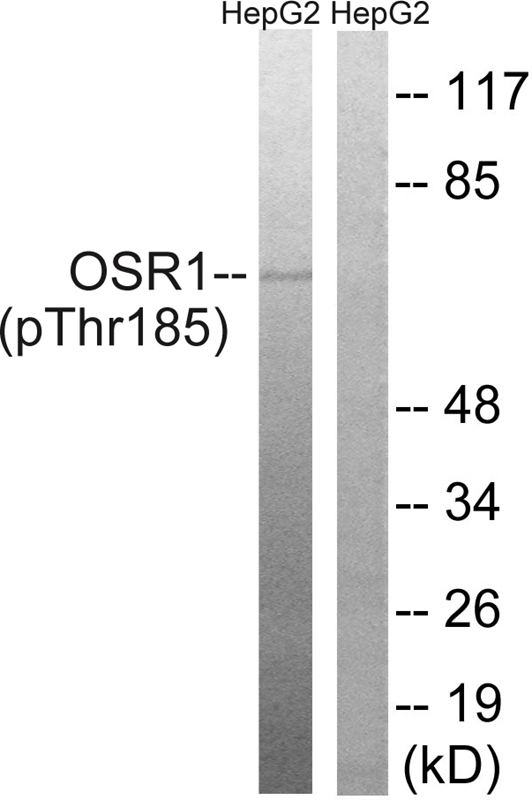 OSR1 (Phospho-Thr185) Antibody