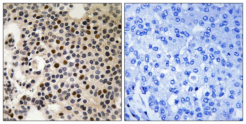 PAK2 (Phospho-Ser197) Antibody