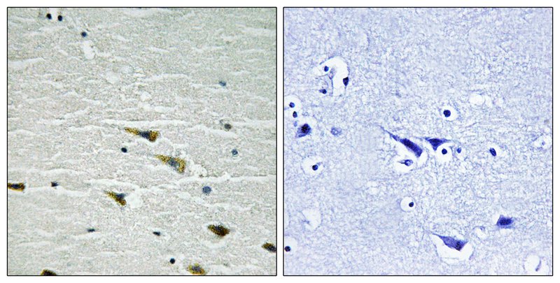 Trk A (Phospho-Tyr757) Antibody