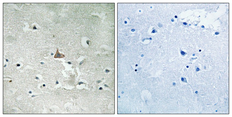 Trk B (Phospho-Tyr706/Tyr707) Antibody