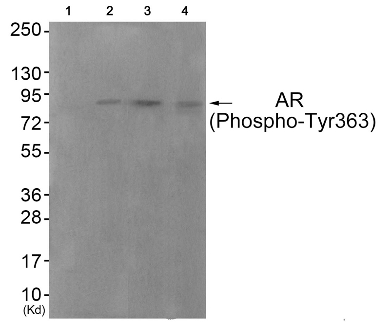 Androgen Receptor (Phospho-Tyr363) Antibody