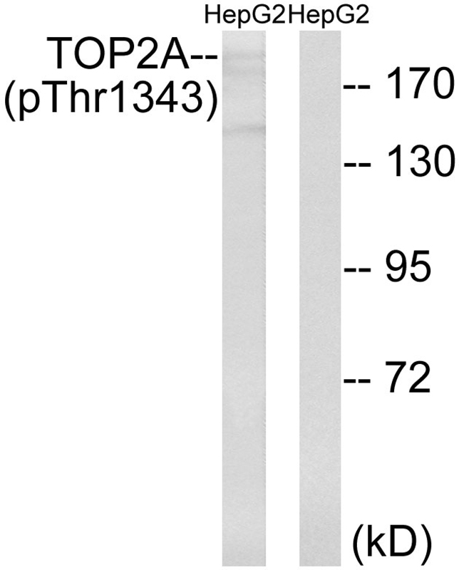 TOP2A (Phospho-Thr1343) Antibody