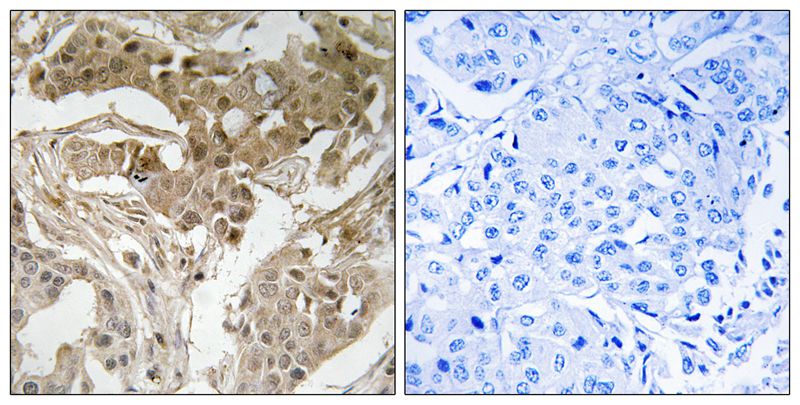 FOS (Phospho-Thr232) Antibody