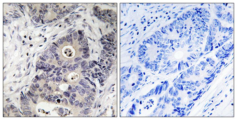 iNOS (Phospho-Tyr151) Antibody