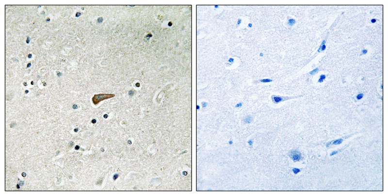 FRS2 (Phospho-Tyr436) Antibody