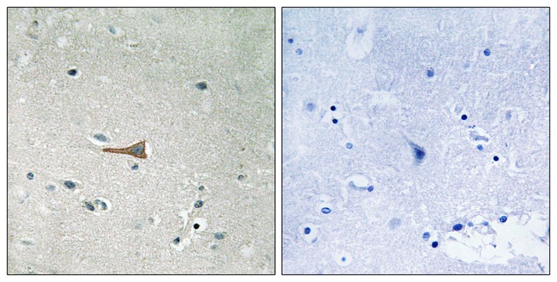 DDR1 (Phospho-Tyr513) Antibody