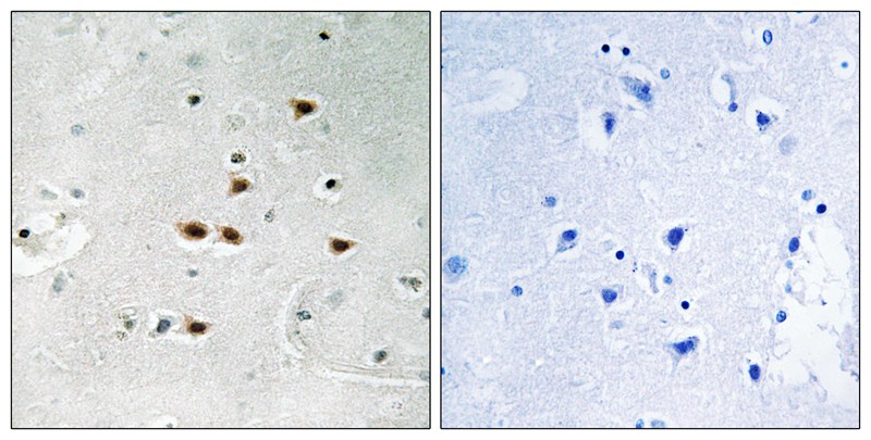 ITCH (Phospho-Tyr420) Antibody