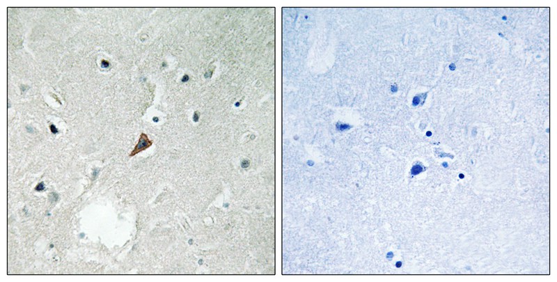 PYK2 (Phospho-Tyr579) Antibody