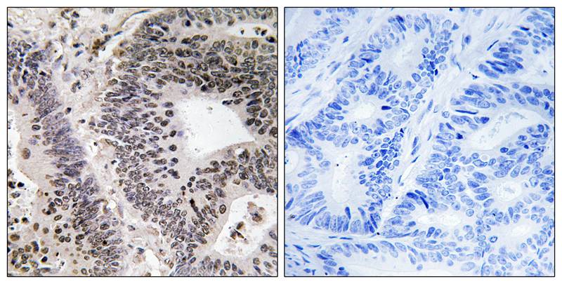 WWOX (Phospho-Tyr33) Antibody