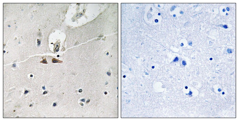 Ephrin B1/B2/B3 (Phospho-Tyr324) Antibody