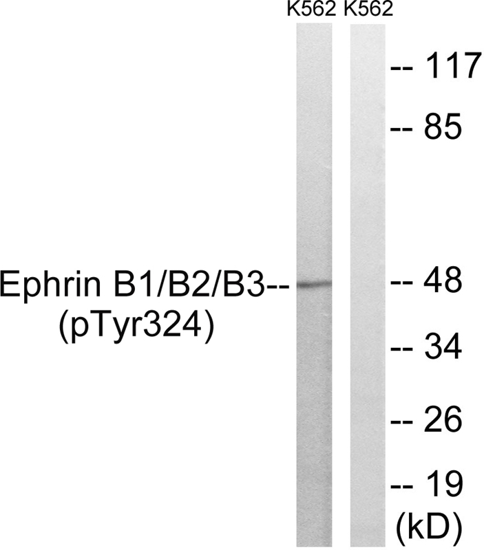 Ephrin B1/B2/B3 (Phospho-Tyr324) Antibody