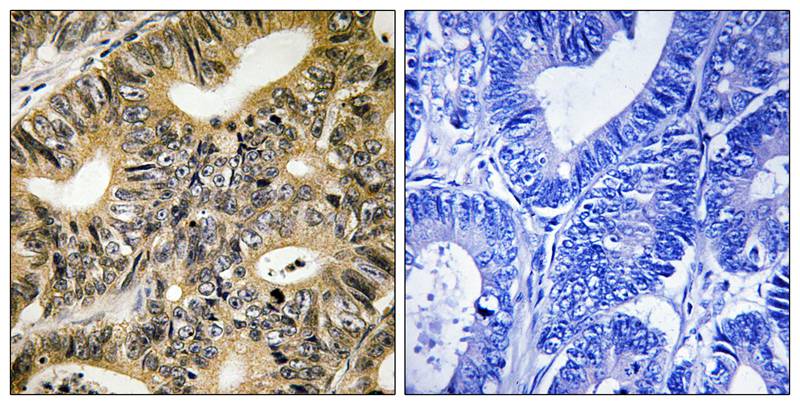 4E-BP1 (Phospho-Thr70) Antibody