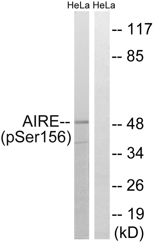 AIRE (Phospho-Ser156) Antibody