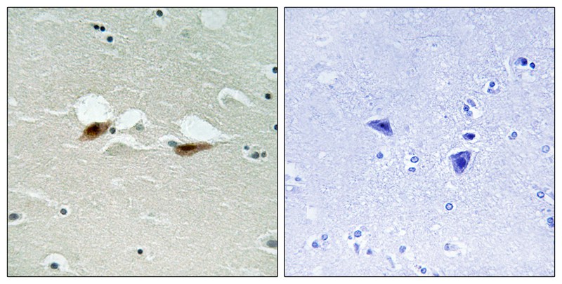 ATF-2 (Phospho-Ser472) Antibody