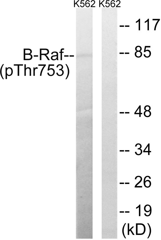 B-Raf (Phospho-Thr753) Antibody