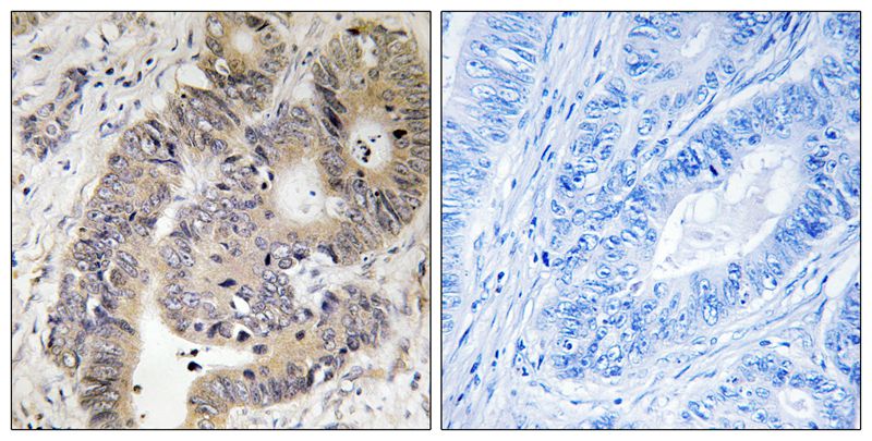 CAD (Phospho-Thr456) Antibody