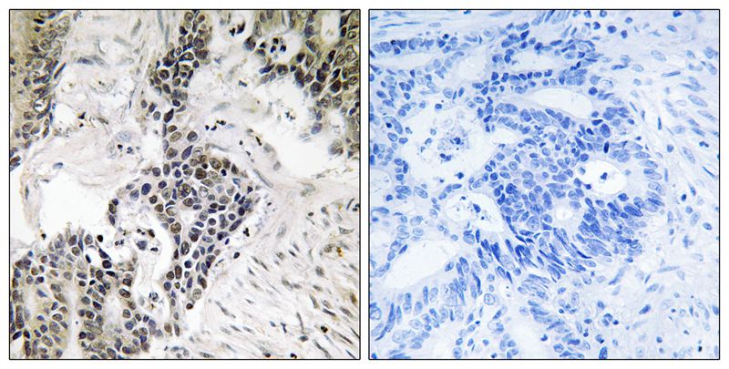 CDC25C (Phospho-Ser198) Antibody