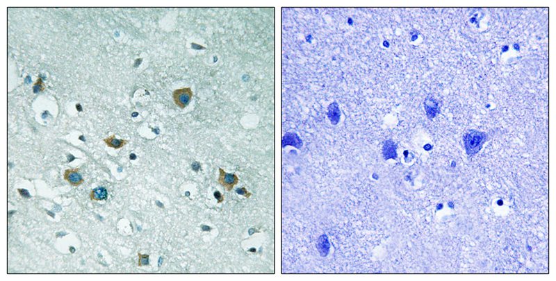 CRMP-2 (Phospho-Thr509) Antibody