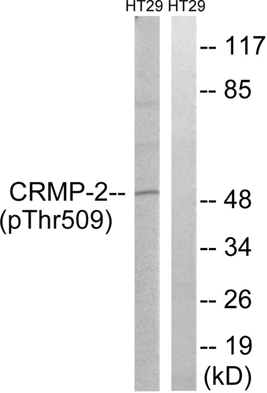 CRMP-2 (Phospho-Thr509) Antibody