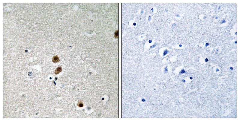 CtBP1 (Phospho-Ser422) Antibody