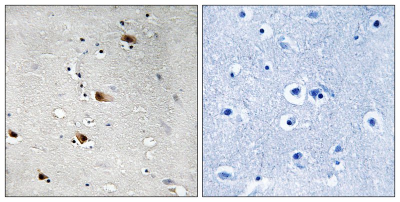 E2A (Phospho-Thr355) Antibody