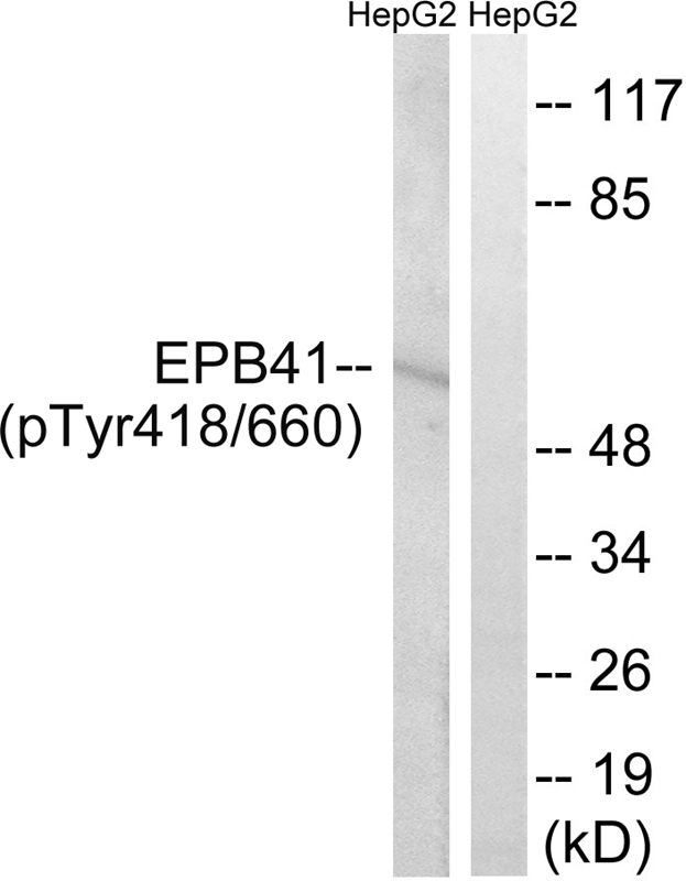 EPB41 (Phospho-Tyr660/418) Antibody